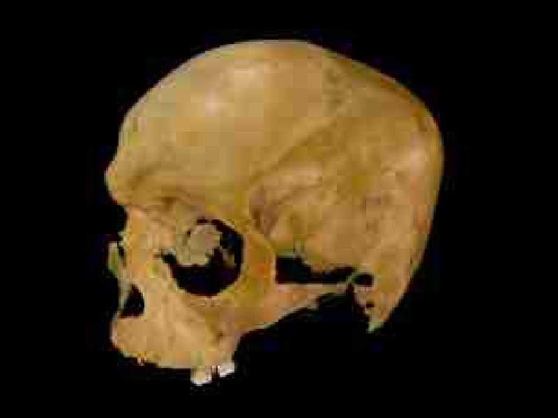 Cranio di un maschio adulto